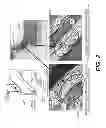 Fig. 03 - Methods and systems for forming reinforced composite articles having variable thickness corners