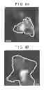 Fig. 06 - CATALYST PARTICLES, CARBON-SUPPORTED CATALYST PARTICLES AND FUEL CELL CATALYSTS, AND METHODS OF MANUFACTURING SUCH CATALYST PARTICLES AND CARBON-SUPPORTED CATALYST PARTICLES