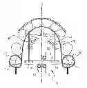 Fig. 01 - Orthodontic supporting member