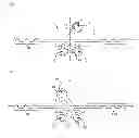 Fig. 02 - Orthodontic supporting member