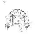 Fig. 06 - Orthodontic supporting member