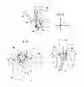Fig. 06 - Method and apparatus for recording spatial gingival soft tissue relationship to implant placement within alveolar bone for immediate-implant placement