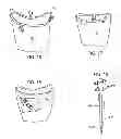 Fig. 08 - Method and apparatus for recording spatial gingival soft tissue relationship to implant placement within alveolar bone for immediate-implant placement