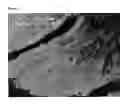 Fig. 02 - Method for improved diagnosis of dysplasias