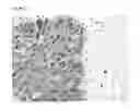 Fig. 08 - Method for improved diagnosis of dysplasias