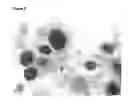 Fig. 09 - Method for improved diagnosis of dysplasias