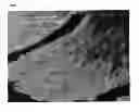 Fig. 02 - Method for Improved Diagnosis of Dysplasias