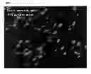 Fig. 03 - Method for Improved Diagnosis of Dysplasias