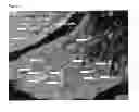 Fig. 04 - Method for Improved Diagnosis of Dysplasias