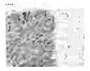 Fig. 08 - Method for Improved Diagnosis of Dysplasias