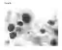 Fig. 09 - Method for Improved Diagnosis of Dysplasias