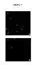Fig. 06 - In situ cloning from pathological tissue specimens