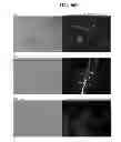 Fig. 75 - COMPOSITIONS AND METHODS FOR REPROGRAMMING MAMMALIAN CELLS