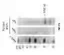 Fig. 35 - IMMUNOSELECTION OF RECOMBINANT VESICULAR STOMATITIS VIRUS EXPRESSING HIV-1 PROTEINS BY BROADLY NEUTRALIZING ANTIBODIES