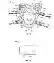 Fig. 02 - Weighted vest