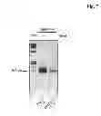 Fig. 09 - Miniaturized, high-throughput nucleic acid analysis