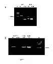 Fig. 02 - Method of profiling gene expression in a subject having colorectal cancer