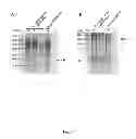 Fig. 04 - Method for one-step purification of recombinant neutrophil-activating protein