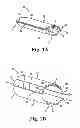 Fig. 02 - Systems, tools, and methods for treatments of pelvic conditions