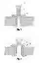 Fig. 08 - WOUND PROTECTOR INCLUDING FLEXIBLE AND RIGID LINERS