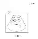 Fig. 09 - System and method for identifying an optimal image frame for ultrasound imaging