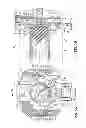 Fig. 07 - Contrast Media Managment Using Patient Renal Function