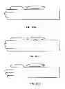 Fig. 02 - Electronic sphygmomanometer for measuring blood pressure and pulse