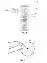 Fig. 06 - Optimization of LV and RV lead placement based on electrical delays