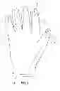 Fig. 02 - ACUPRESSURE GLOVE