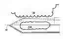 Fig. 01 - Biopsy device