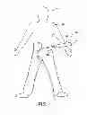 Fig. 02 - Biopsy device