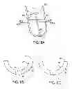Fig. 09 - Biopsy device