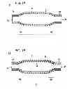 Fig. 02 - Balloon and balloon catheter