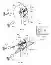 Fig. 02 - NERVE TREATMENT SYSTEM