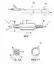 Fig. 02 - MEDICAL DEVICE HAVING TISSUE ENGAGING MEMBER AND METHOD FOR DELIVERY OF A THERAPEUTIC AGENT