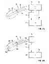 Fig. 08 - CATHETER AND CATHETER SYSTEM