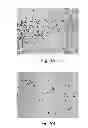 Fig. 07 - Methods and devices for selective disruption of visceral fat by controlled cooling