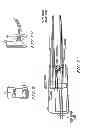 Fig. 06 - THERMAL CAUTERY SURGICAL FORCEPS