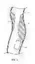 Fig. 07 - Vessel clearing apparatus, devices and methods