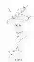 Fig. 02 - Pressure-sensitive flexible polymer bipolar electrode
