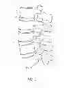 Fig. 02 - Method and apparatus for minimally invasive insertion of intervertebral implants