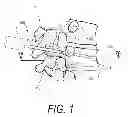 Fig. 02 - Bone treatment systems and methods