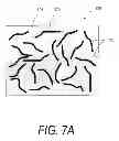 Fig. 09 - Bone treatment systems and methods