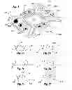 Fig. 04 - Methods and systems for directing movement of a tool in hair transplantation procedures