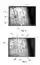 Fig. 06 - Methods and systems for directing movement of a tool in hair transplantation procedures