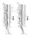 Fig. 28 - Endoscopic surgical clip applier