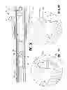 Fig. 40 - Endoscopic surgical clip applier