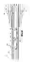 Fig. 41 - Endoscopic surgical clip applier