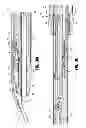 Fig. 44 - Endoscopic surgical clip applier