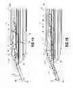 Fig. 28 - Endoscopic surgical clip applier